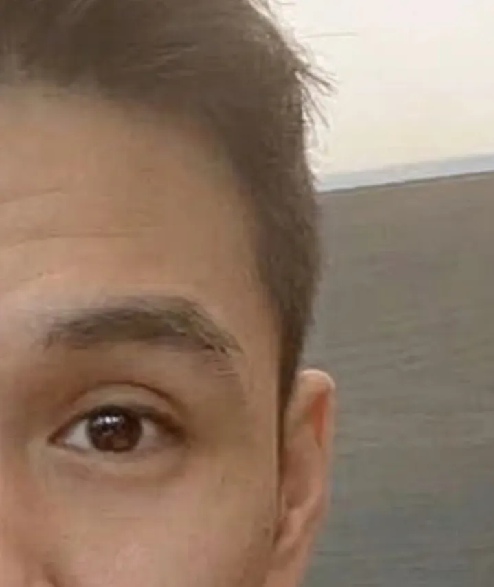 dp