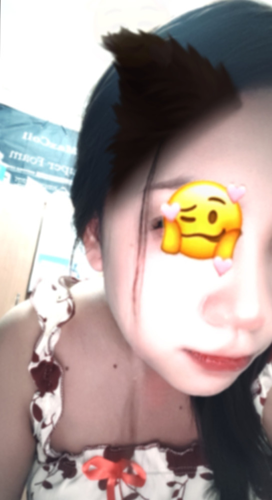 dp
