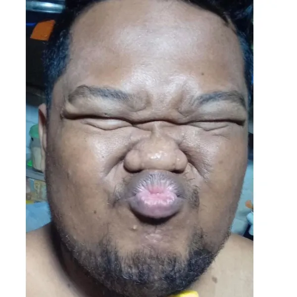 dp